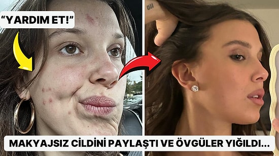 "Yardım Edin!": Millie Bobby Brown'un Makyajsız ve Sivilceli Cildini İnternette Paylaşması Gündem Oldu!