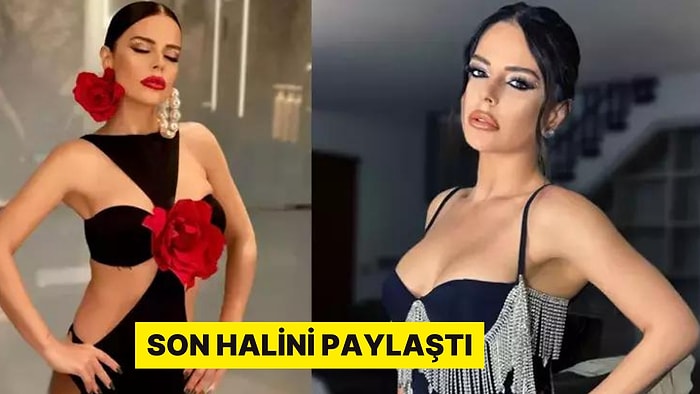 Ünlü Sanatçı Hedefi Olan 46 Kiloya Düştü: Son Halini Paylaştı