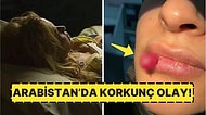 Hamile Kadının Ağzında Oluşan Tümörü Görünce Ufak Çaplı Bir Şok Geçireceksiniz!