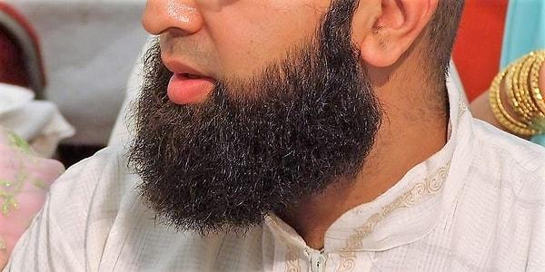 Aslında çeşitli İslami hareketler içerisinde sakal konusunda farklı görüşler var. Bazıları sakalın belirli bir miktardan az olmaması gerektiğini savunurken Taliban sakalın komple kesilmesine bile karşı çıkıyor.
