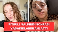 Pitbull Saldırısından Sonra Burnunda Kıllar Çıkmaya Başlayan Kız İnternet Zorbalarına Boyun Eğmedi