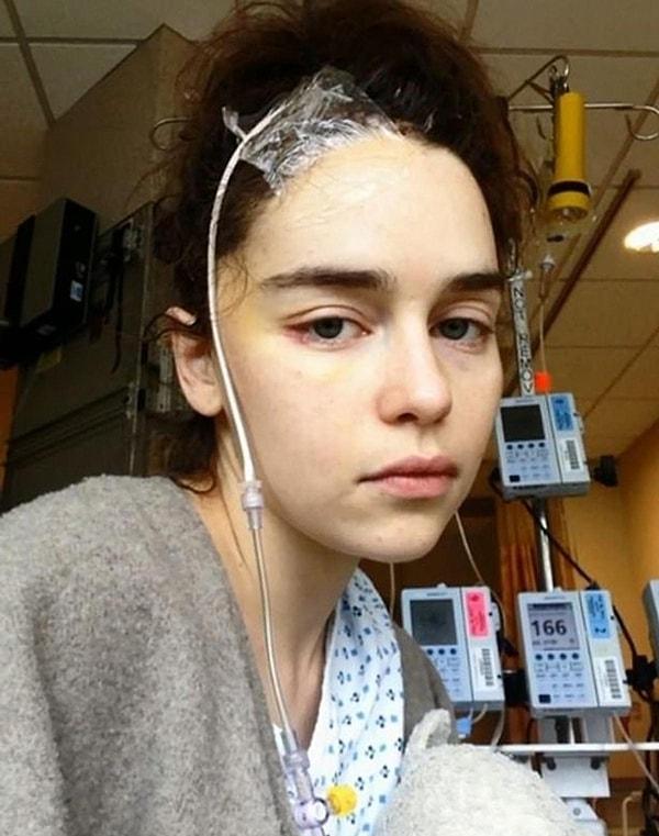 Emilia, 2013 yılında dizinin ilk sezonundan sonra beyin anevrizması geçirmişti ve acilen ameliyata alındığını açıklamıştı.