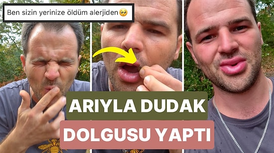 Yakaladığı Arıyla Kendisine Dudak Dolgusu Yapan Adamın Videosu Tepki Çekti