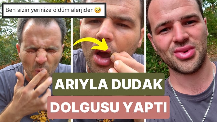 Yakaladığı Arıyla Kendisine Dudak Dolgusu Yapan Adamın Videosu Tepki Çekti