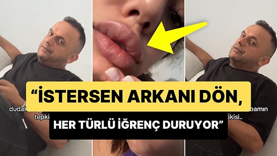 Dudak Dolgusu Yaptıran Genç Babasının Tepkisini Kaydetti: 'İstersen Arkanı Dön İğrenç Duruyor'