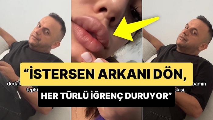 Dudak Dolgusu Yaptıran Genç Babasının Tepkisini Kaydetti: 'İstersen Arkanı Dön İğrenç Duruyor'