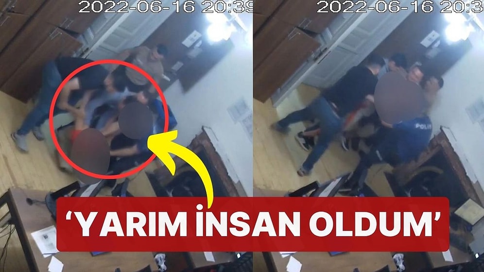 Karakolda Darp Edildi, Bir Testisini Kaybetti: 'Yarım İnsan Oldum'