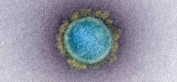 Bilim dünyası da bu yüzden son zamanlarda virüslerle ilgili çalışmalarını arttırdı. Yapılan yeni bir araştırma daha gösterdi ki yeni bir virüs türüyle karşı karşıyayız.