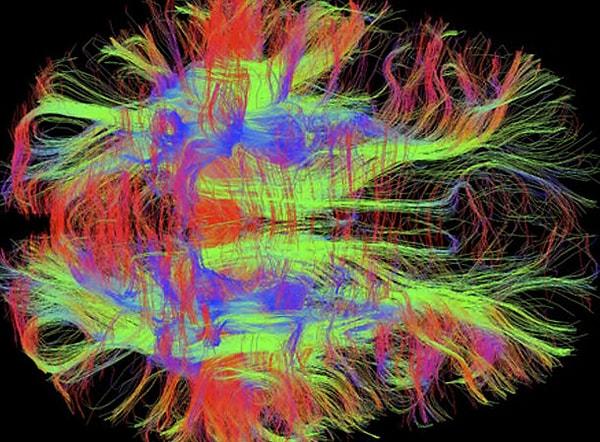 3. Beyniniz, 86 milyardan fazla nörondan oluşuyor ve her nöron yaklaşık 10 bin nöronla iletişim kuruyor. Ancak insan beynini anlamak, sadece bu bağlantıların 'nasıl' olduğunu bilmekten daha fazlasını gerektiriyor.