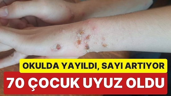 Hatay'da Su Problemi Devam Ediyor: Bir Okulda 70'ten Fazla Çocukta Uyuz Tespit Edildi
