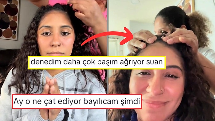 Saçını Çektirerek Baş Ağrısını Sonsuza Dek Geçirdiğini İddia Eden Kadın Viral Oldu!