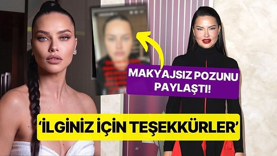 Adriana Lima 'Estetik' İddialarına Makyajsız Fotoğraf Paylaşarak Cevap Verdi! 'İlginiz İçin Teşekkürler'