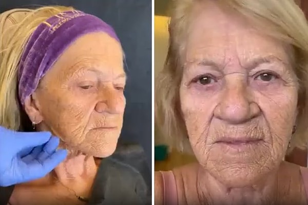 Sosyal medyada paylaşılan ve gündem olan bir videoda da yüzünde kırışıklıklar ve sarkmalar olan bir kadın görülüyor.