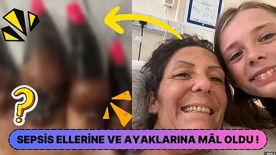 Septik Şok Geçirip Parmaklarını ve Ayaklarını Kaybeden Kadın Yaşadığı Acılı Süreci Anlattı