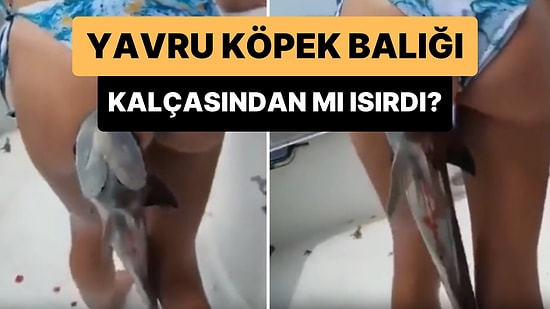 'Köpek Balığı Tarafından Kalçasından Isırılan Kadın'ı Gösterdiği İddia Edilen Görüntüler Gündem Oldu