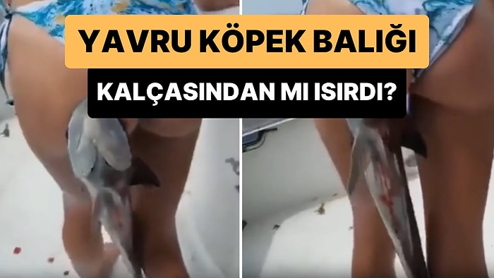 'Köpek Balığı Tarafından Kalçasından Isırılan Kadın'ı Gösterdiği İddia Edilen Görüntüler Gündem Oldu