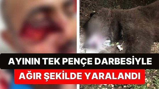 Kütahya'da Ayı Saldırısı! Araç Sürücüsünün Yüzü Paramparça Oldu