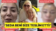 Görenler Şaştı Kaldı: Seda Sayan'ın Ablası, Yanlış Müdahale Sonucu Deforme Olan Yüzünü Adeta Baştan Yaptırdı!