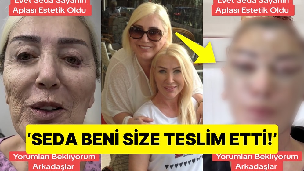 Görenler Şaştı Kaldı: Seda Sayan'ın Ablası, Yanlış Müdahale Sonucu Deforme Olan Yüzünü Adeta Baştan Yaptırdı!