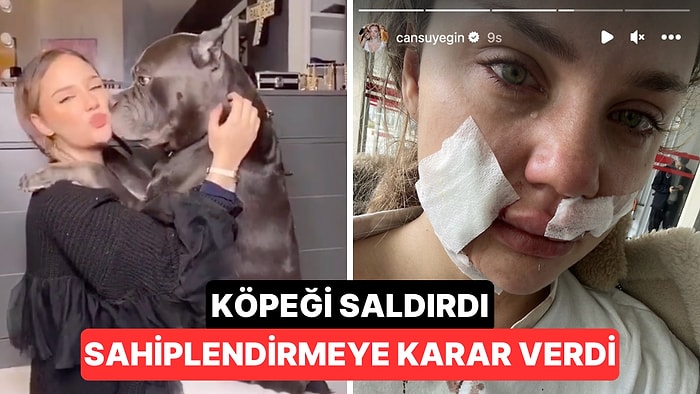 8 Yıldır Baktığı Köpeğinin Saldırısına Uğrayan Cansu Yeğin Takipçilerini Korkuttu