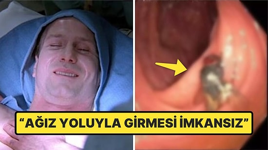 Genel Kontrol İçin Doktora Gittikten Sonra Bağırsağından Canlı Sinek Çıkan Adam Tıp Dünyasını Şok Etti