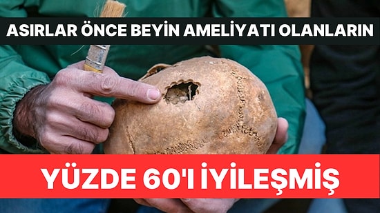 Van'da Kazı Çalışmaları Devam Ediyor: 400 İskeletin 30'unda Beyin Ameliyatı İzleri Çıktı