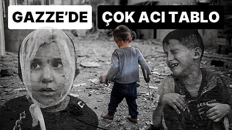 Gazze’deki En Acı Tablolardan Biri: 900 Civarında Çocuk Uzuvlarını Kaybetti