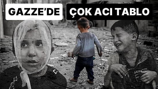 Gazze’deki En Acı Tablolardan Biri: 900 Civarında Çocuk Uzuvlarını Kaybetti