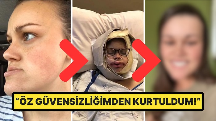 Çene Operasyonu Geçirerek Adeta Bambaşka Birine Dönüşen Kadın, Yaşadığı Sancılı Süreci Anlattı