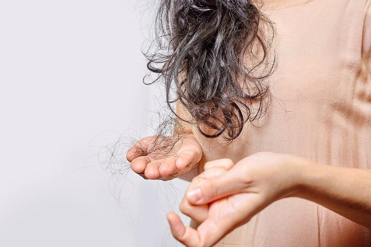 تساقط الشعر