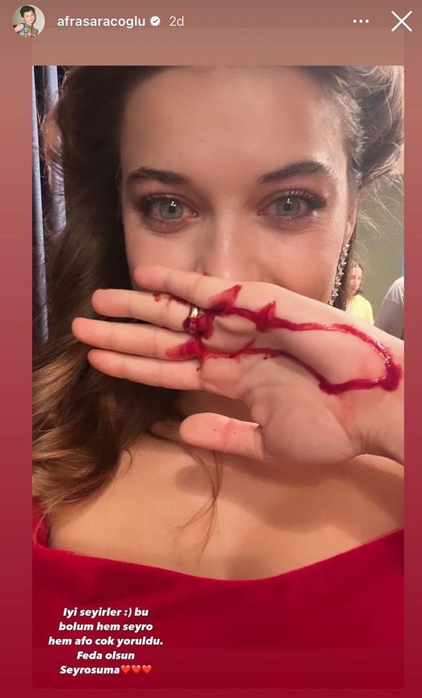 Söz konusu sahnenin ardından Instagram hesabından paylaşım yapan Afra Saraçoğlu, o sahneyi çekerken elini yaraladığını şu sözlerle açıkladı: