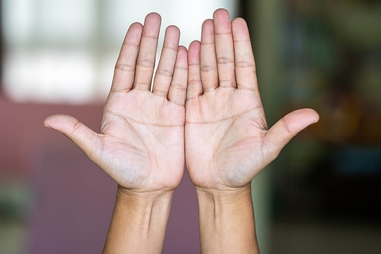 What Do Your Hands Say About Your Health?
