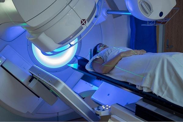 Kanser hücreleri ameliyat edilebilecek boyuttan daha büyük ya da fazla alana yayıldıysa öncelikle radyoterapi uygulanır. Peki radyoterapi nedir?