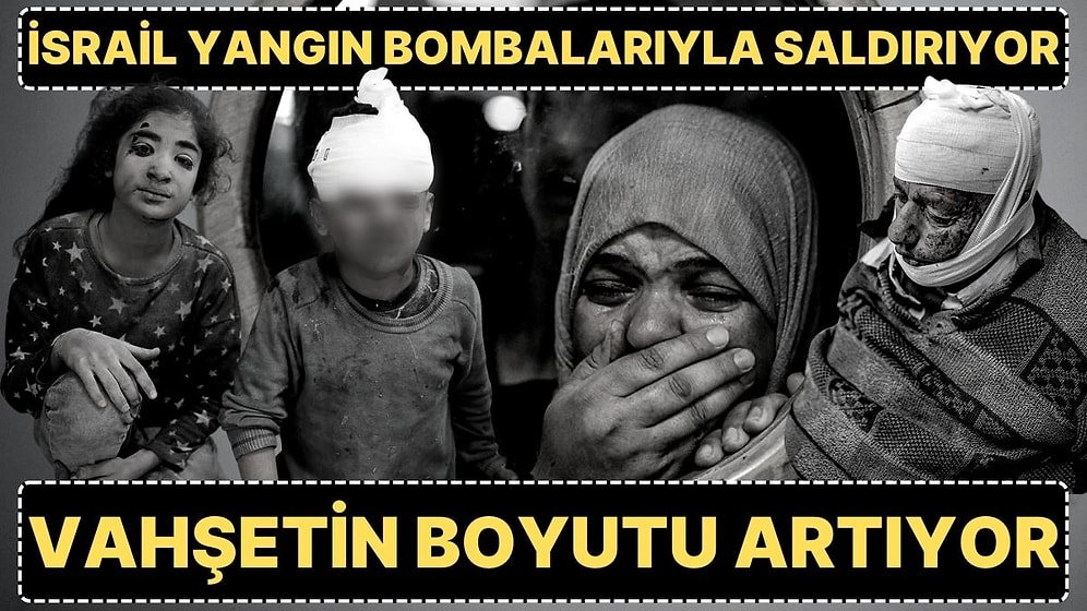 Filistin Sağlık Bakanlığı: "Yaralılarda Daha Önce Görülmemiş Yanıklar ve Boğulmalar Oluyor"
