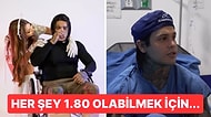 15 Santim Uzayabilmek İçin 175 Bin Dolarlık Acısı Tarif Edilemez Bir Ameliyata Girdi!