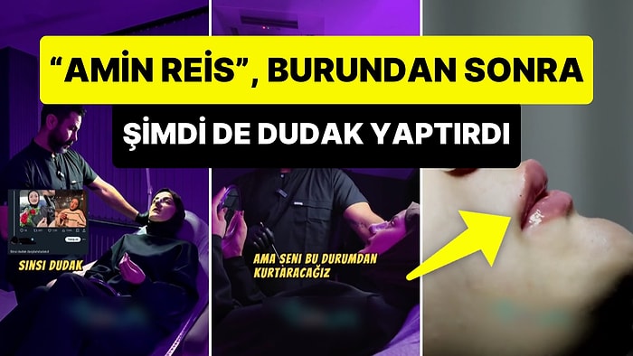 'Amin' Dediği Anlar ile Fenomen Olan Gizem Yıldız Şimdi de Dudak Estetiği Yaptırdı