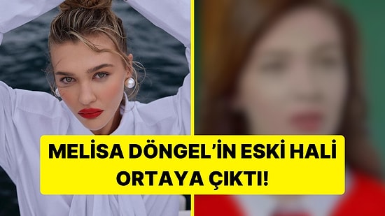 Eski Hali Ortaya Çıktı! Kirli Sepeti'nin Aylin'i Melisa Döngel'in Estetiksiz Görüntüsü Şaşırttı