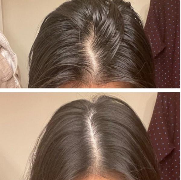 3. Kuru şampuan sayesinde yağlı saçlara hızlıca elveda diyebilirsiniz, aynı zamanda saçlarınıza hacim kazandırıp daha dolgun görünmesini de sağlayabilirsiniz.