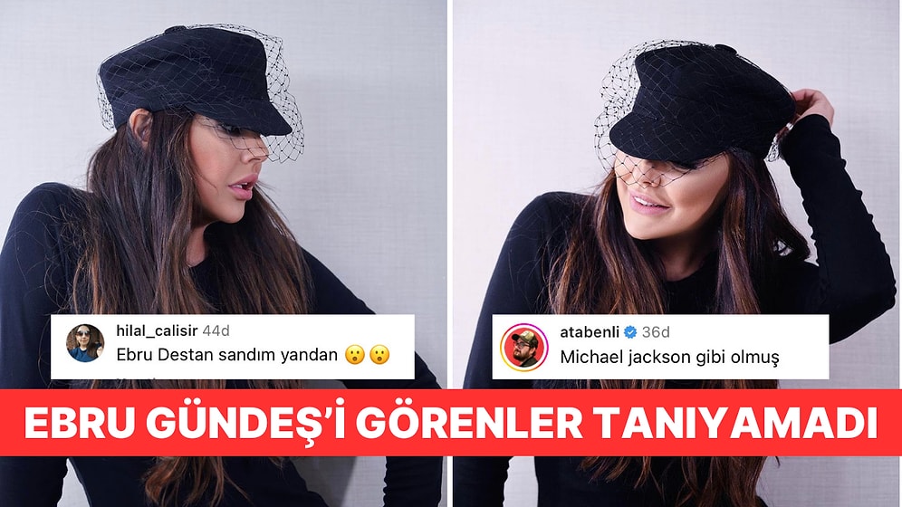 Ebru Gündeş Yaptırdığı Estetiklerle Dikkat Çekti: Kimse Yeni Halini Tanıyamadı