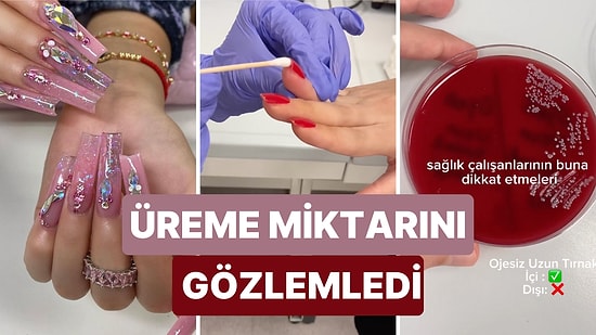 Uzun Tırnak Sevenler Dikkat! Tırnaklardan Örnek Alınıp Besiyerine Sürüldü ve Ortaya Çıkan Sonuç Dikkat Çekti