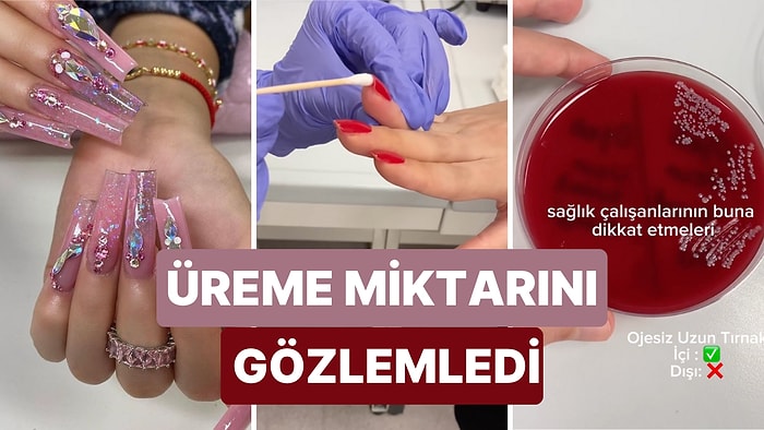 Uzun Tırnak Sevenler Dikkat! Tırnaklardan Örnek Alınıp Besiyerine Sürüldü ve Ortaya Çıkan Sonuç Dikkat Çekti