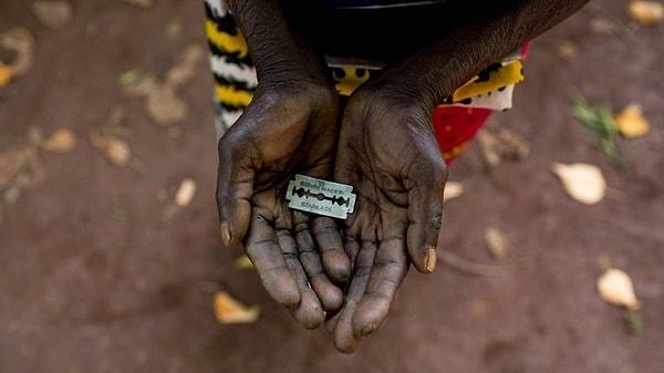 "Genital Sakatlanma" olarakta bilinen kadın sünnetin özellikle Afrika ve Orta Doğu'daki bazı ülkelerde hala yaygın durumda.