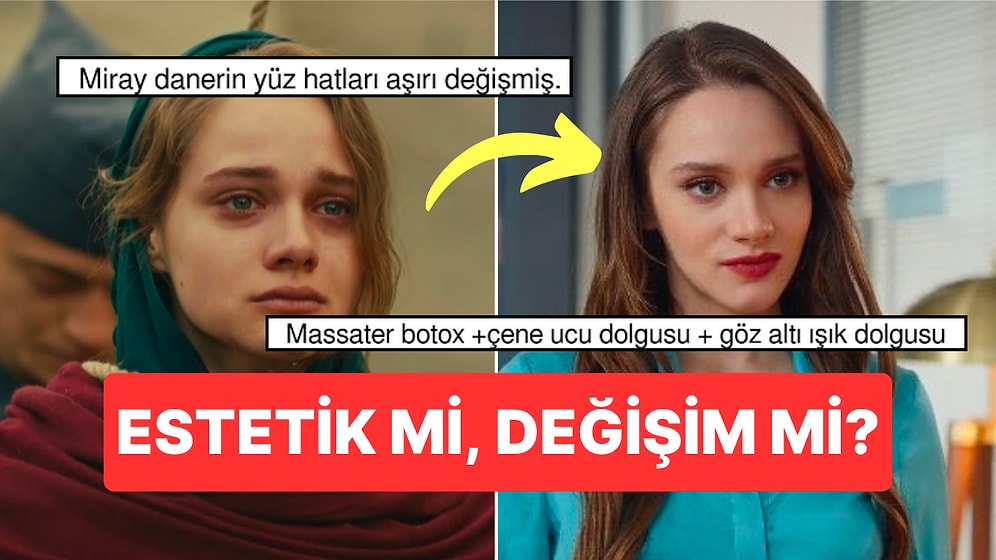 Kuş Uçuşu Dizisiyle Seyirci Karşısına Çıkan Miray Daner'in Yüzündeki Değişim Estetik İddialarına Sebep Oldu