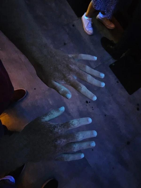 15. "UV ışığı altında ellerim."