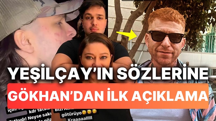 Nurgül Yeşilçay'ın "Gözünüzde Büyütmeyin" Sözlerine Gökhan Özoğuz'dan İlk Cevap Geldi