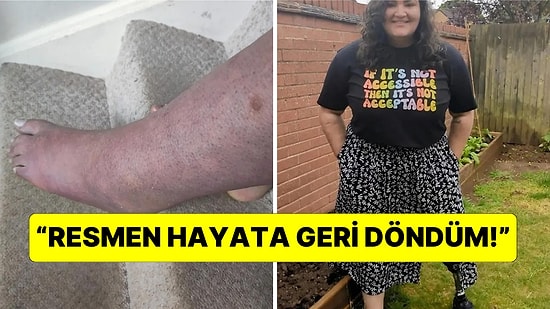 "Bacağımı Kesin" Diyerek Yalvaran İntihar Hastalığına Sahip Kadının İçimizi Parçalayan Hikayesi