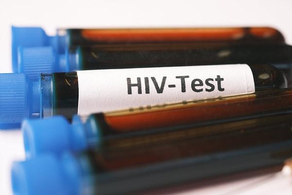 Ücretsiz HIV Testi uygulaması, Sarıyer Belediyesi’nin desteği ile etkisini büyütüyor. Sarıyer Belediyesi’nin uygulamada üstlendiği görevleri aktaran Sağlık İşleri Müdürü Dr. Armağan Eren, şu bilgileri verdi: