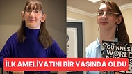 Dünyanın En Uzun Kadını Rumeysa Gelgi Günlük Hayatta Çektiği Zorlukları Paylaştı