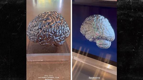 Kardashian'a, daha önce MR cihazının reklamını yaptığı merkezden bizzat kendi beyninin 3D modeli hediye edildi.