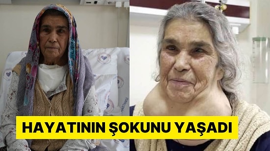 50 Yıldır Doktor Korkusundan Hastaneye Gitmiyordu: 2 Kiloluk Guatrı Ameliyatla Alındı